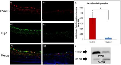 Parvalbumin expression changes with retinal ganglion cell degeneration